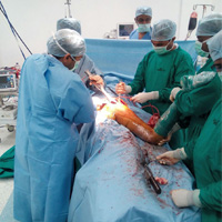 Knee Replacement Surgery in Nashik